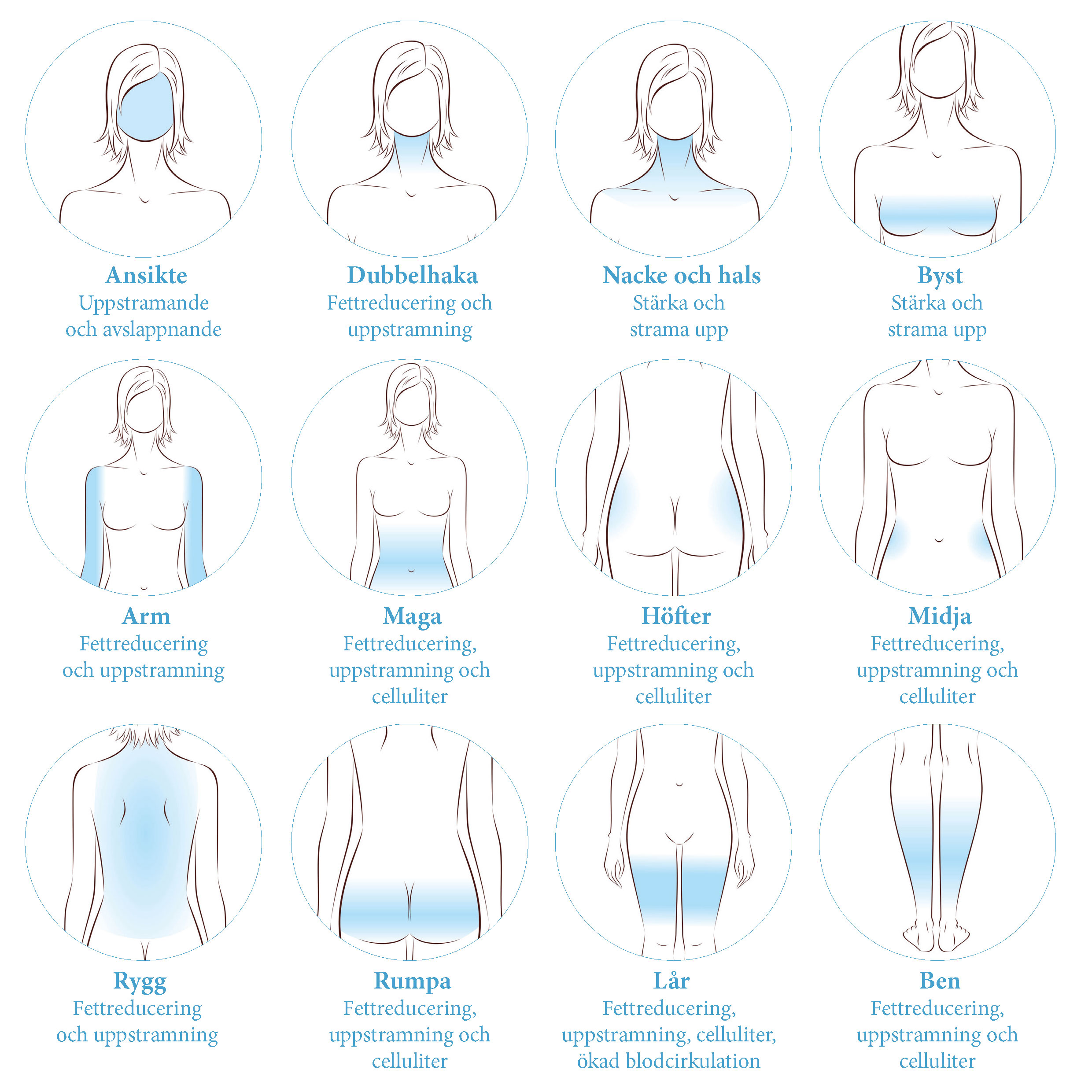 bilde av områder som kan behandles med Cryoterapi